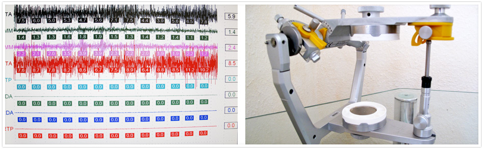 Funktionsorientierte Rehabilitation 